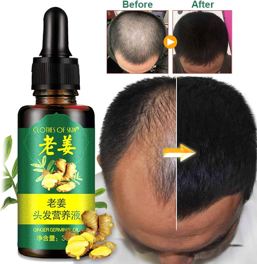 7 Day Ginger Germinal Oil Hair Nutrient Solution